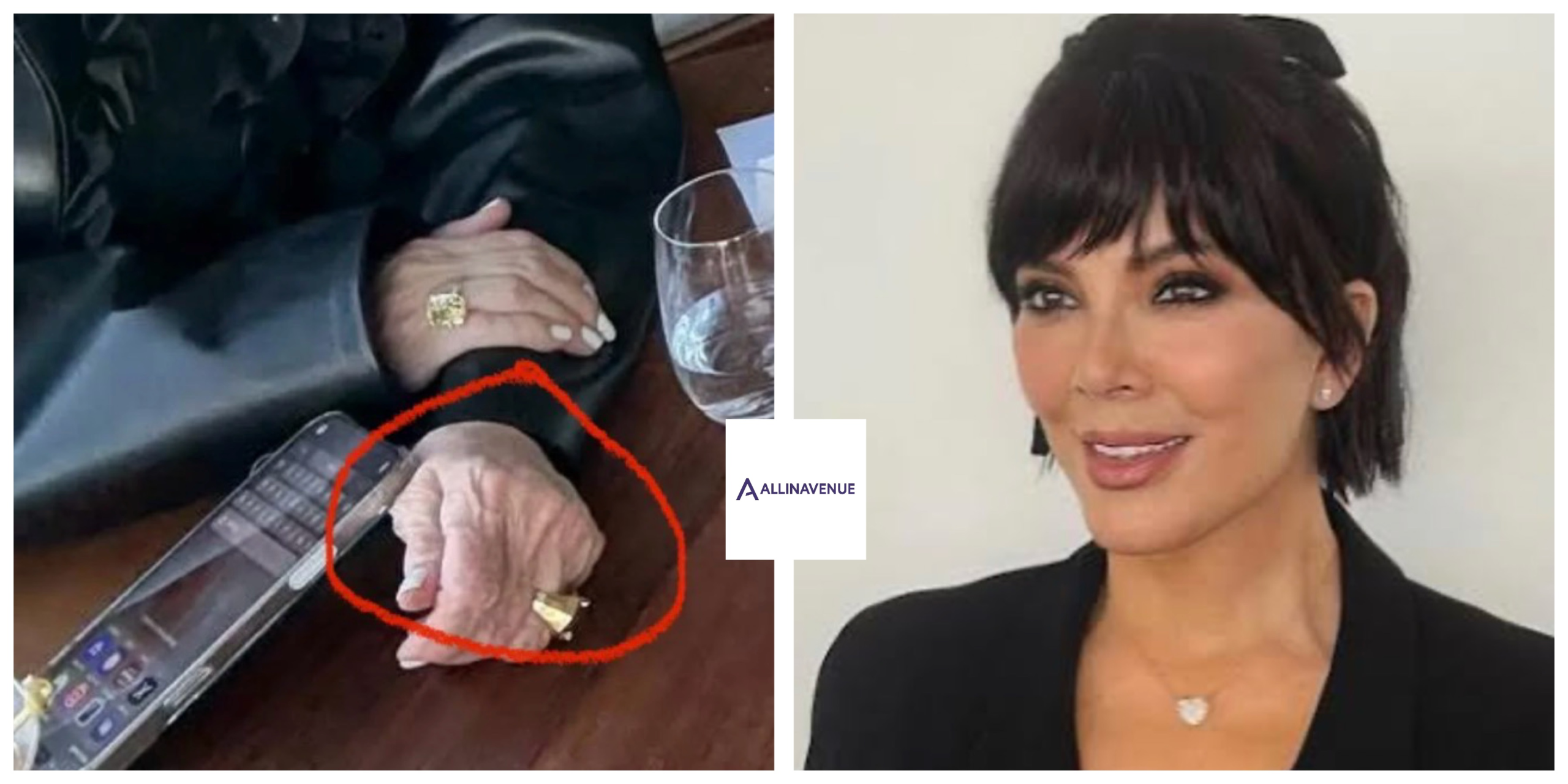 Turning Back Time at Any Cost? Doctors Sound Alarm Over Kris Jenner’s Hand Procedures…
