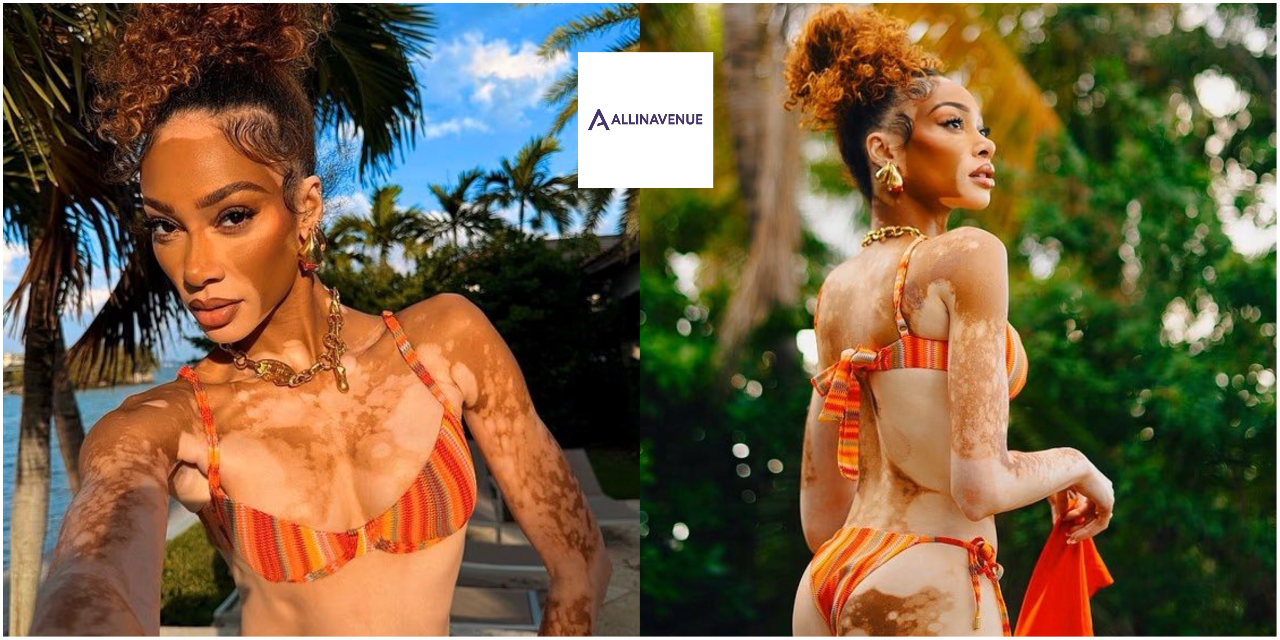 Winnie Harlow Turns Up the Heat in Stunning Bikini Photos…